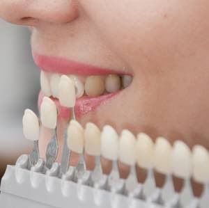 Cosmetic Dentistry & Fillings